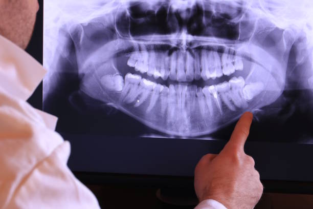Best Emergency Root Canal Therapy in Tea, SD
